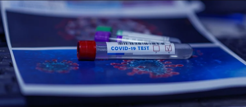 Coronavirus : 147 établissements pour personnes âgées testés en Occitanie