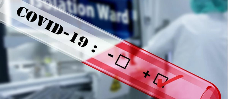 La mairie ouvre un centre de test Covid 19