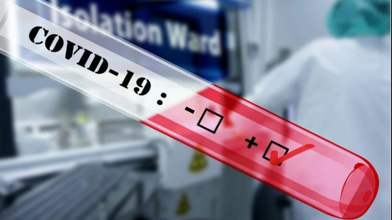 Covid : Un test de - de 24h pour revenir d'Espagne ou du Portugal