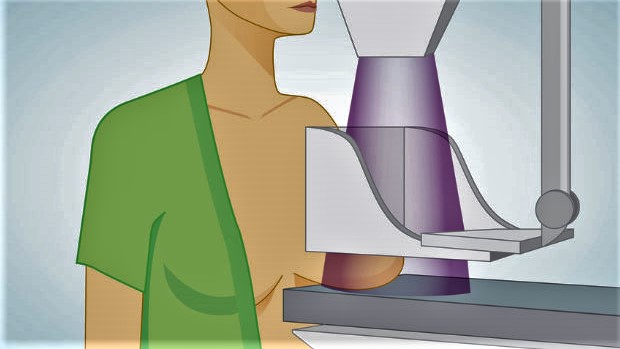 mammographie a.jpg