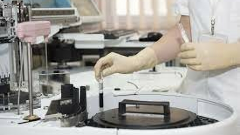 Les laboratoires de biologie médicale se mettent en grève